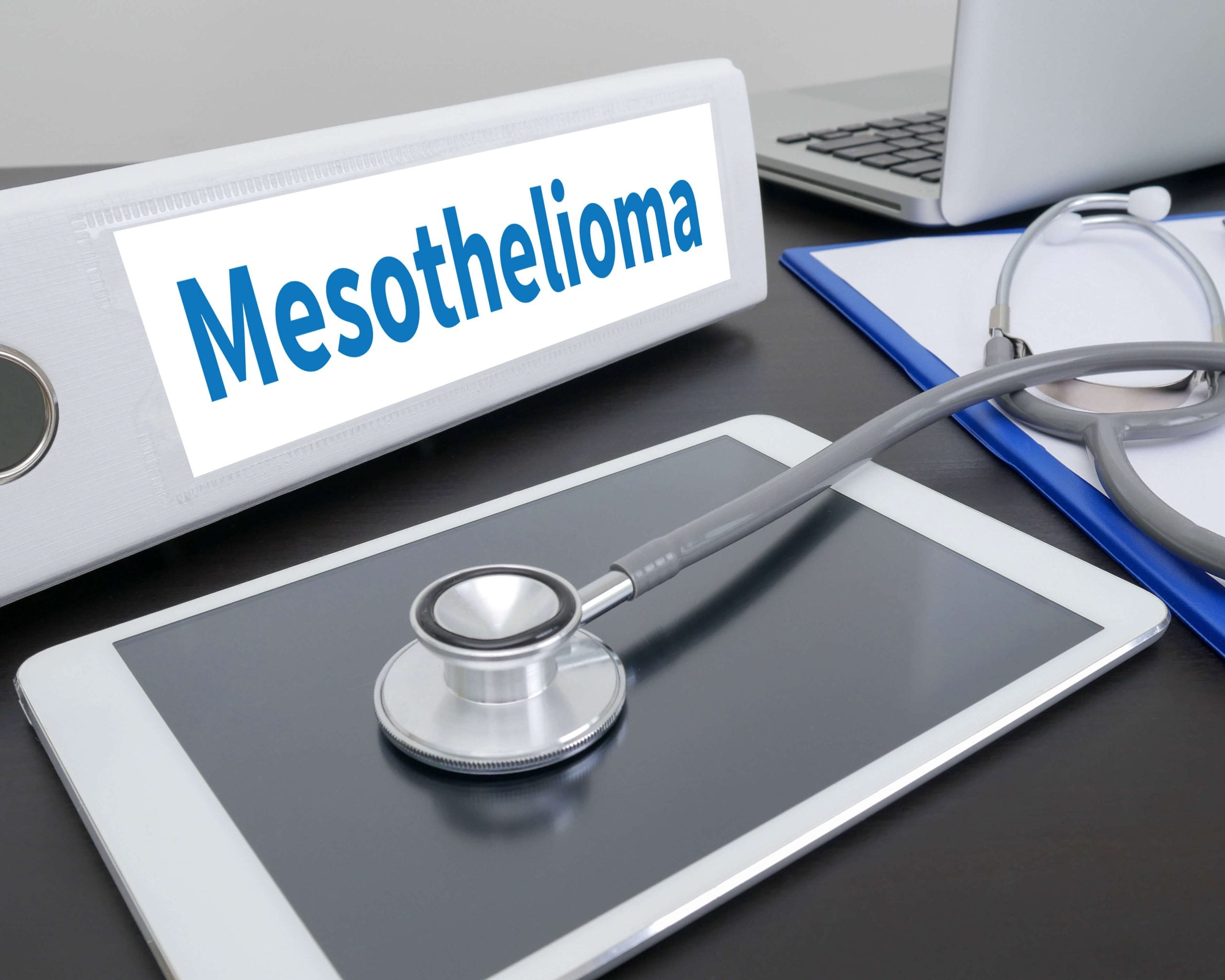 Stages-of-Mesothelioma in Newport
